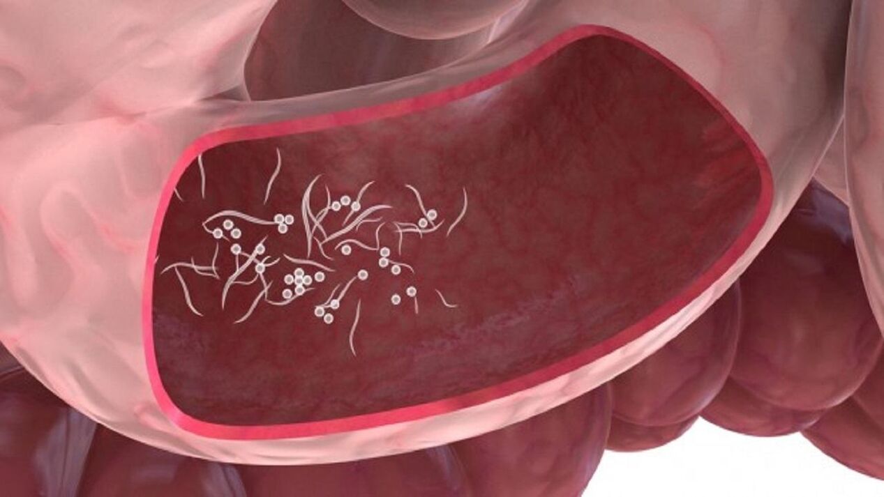 Giardia паразитира в черния дроб