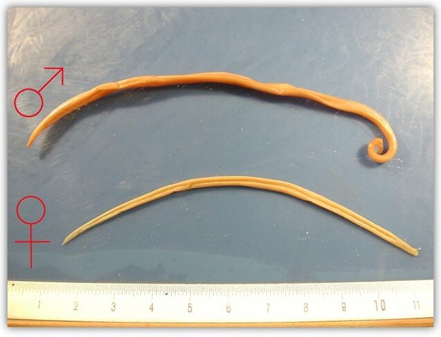 как изглеждат кръглите червеи