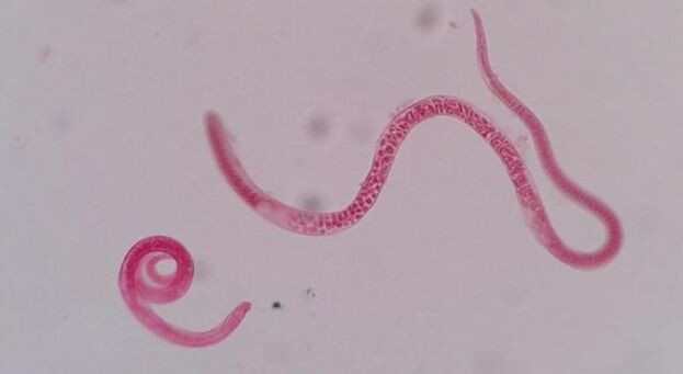 как изглеждат трихинелите