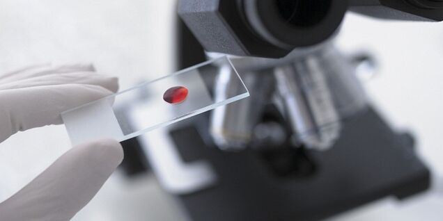 кръвен тест за диагностициране на паразити в тялото